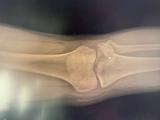 video thumbnail (2)