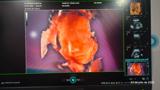 video thumbnail (13)